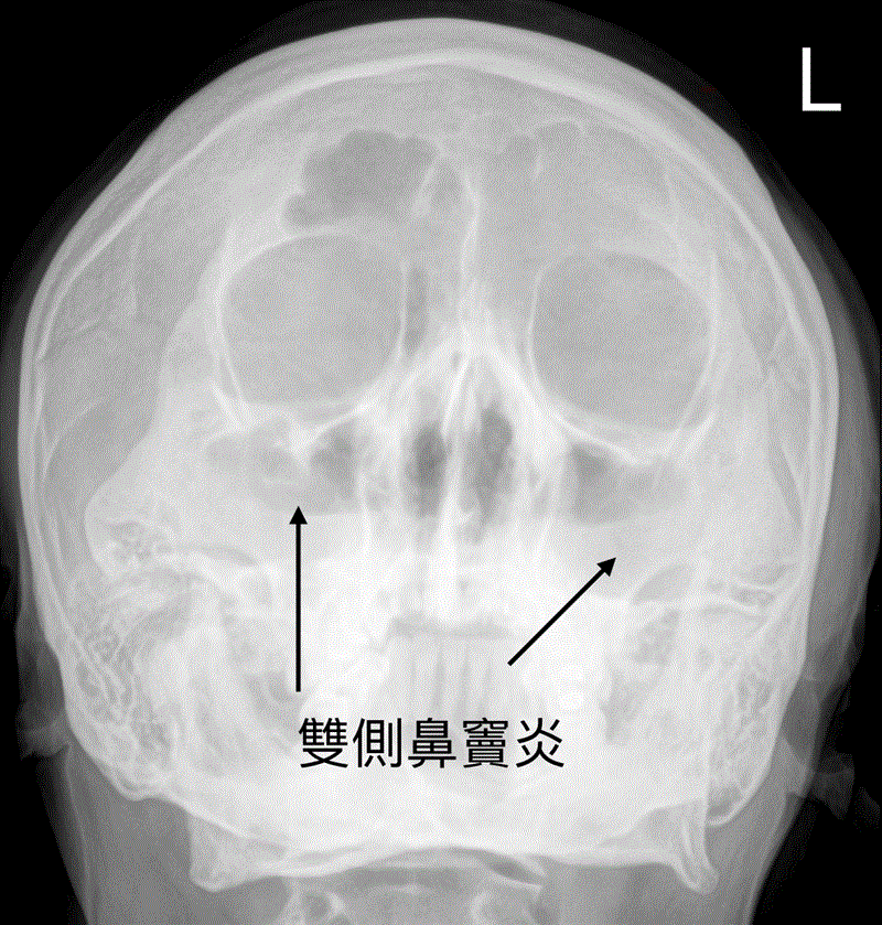 博林胸腔內科診所